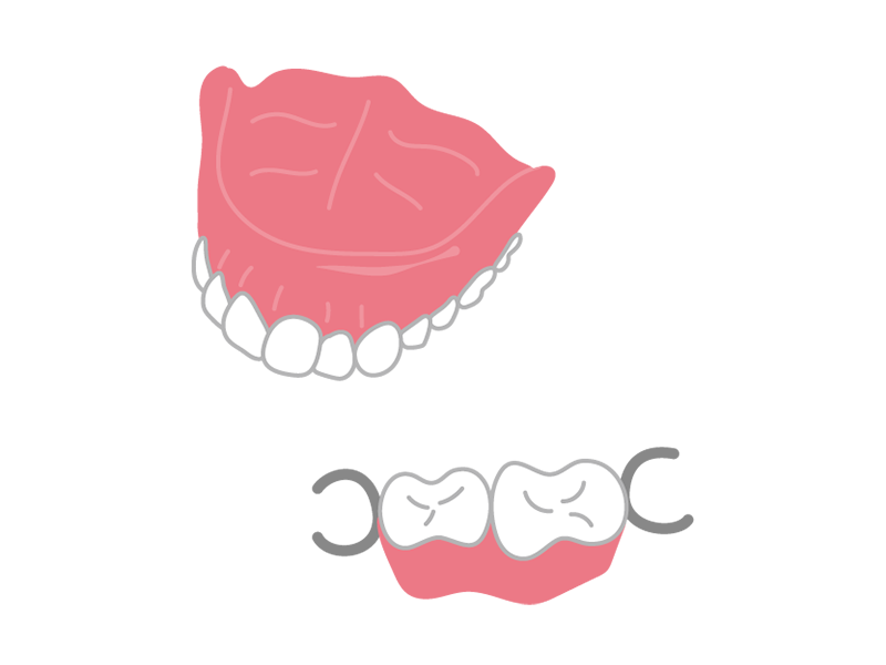 部分入れ歯　総入れ歯